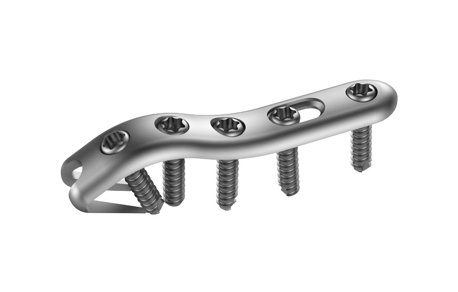 Jones Fracture Plate implant system